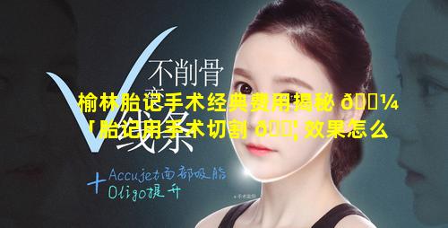 榆林胎记手术经典费用揭秘 🌼 「胎记用手术切割 🐦 效果怎么样」